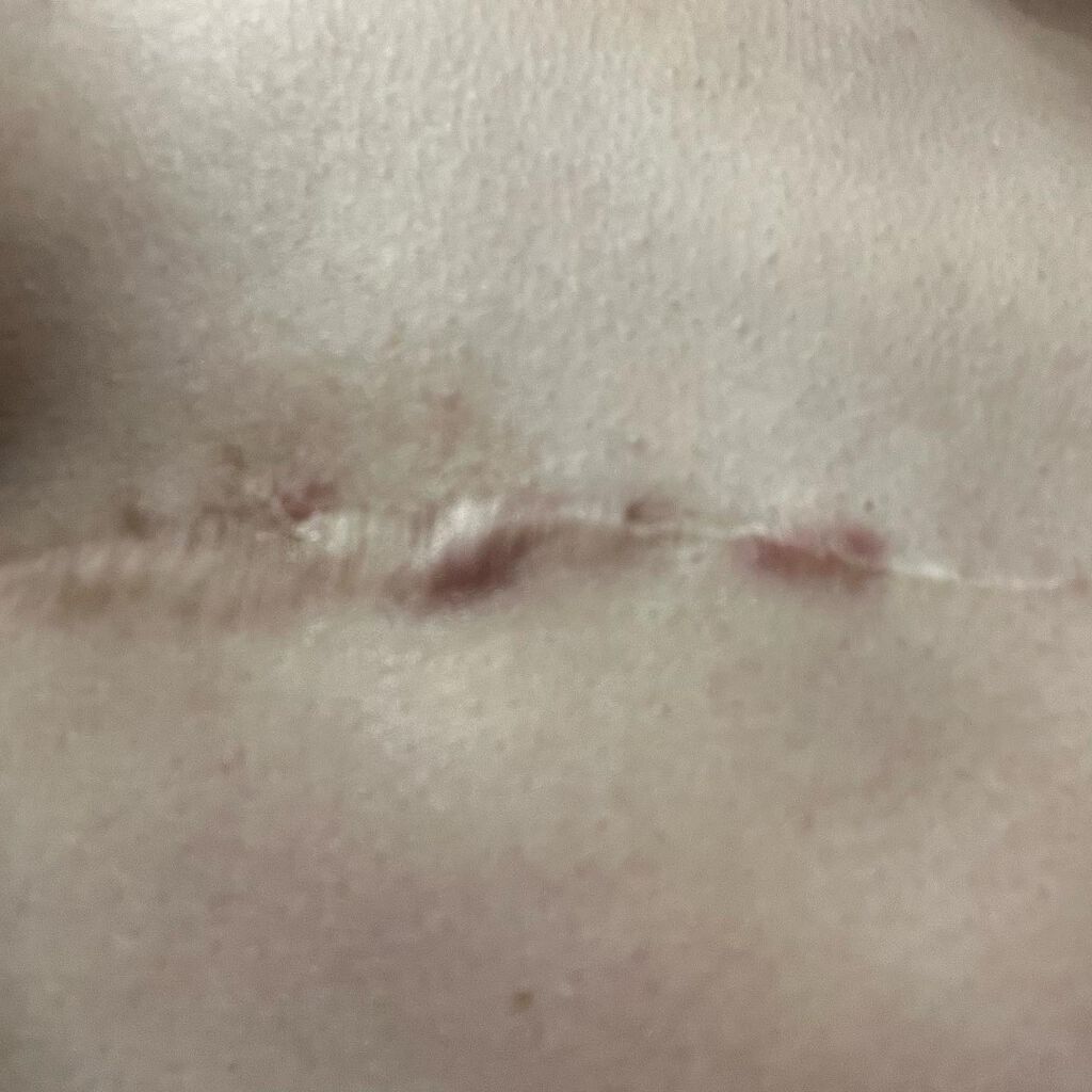 マーシュフィールド SC ボディカバーファンデN/マーシュ・フィールド/クリーム・エマルジョンファンデーションを使ったクチコミ(1枚目)