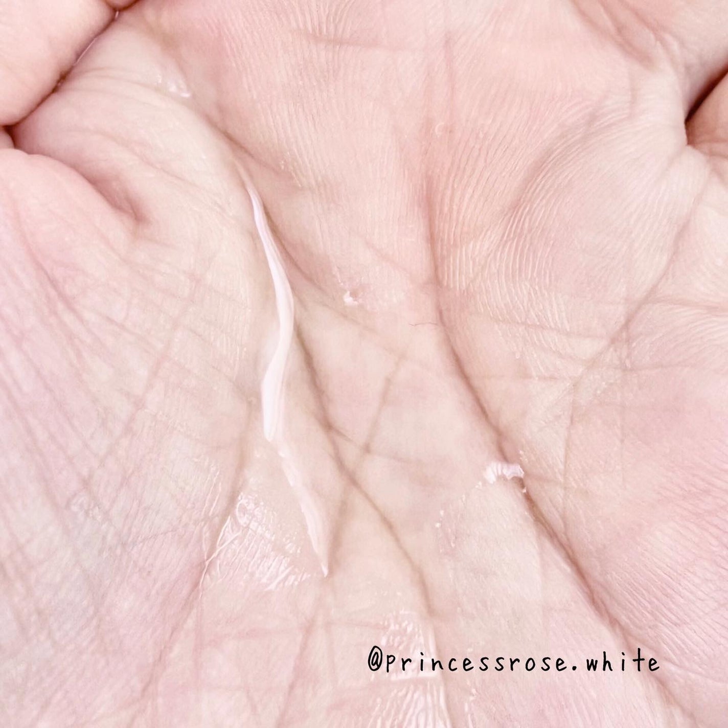 ピンクティーツリートナー/APLIN/化粧水を使ったクチコミ(5枚目)