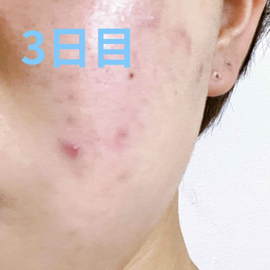 豆 on LIPS 「お待たせしました〜!(待ってない)今回は病院で処方してもらった..」(3枚目)