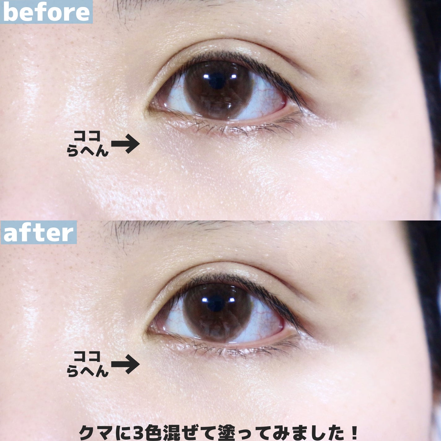 TIMAGE クリーミーコンシーラーパレット/TIMAGE/パレットコンシーラーを使ったクチコミ(5枚目)