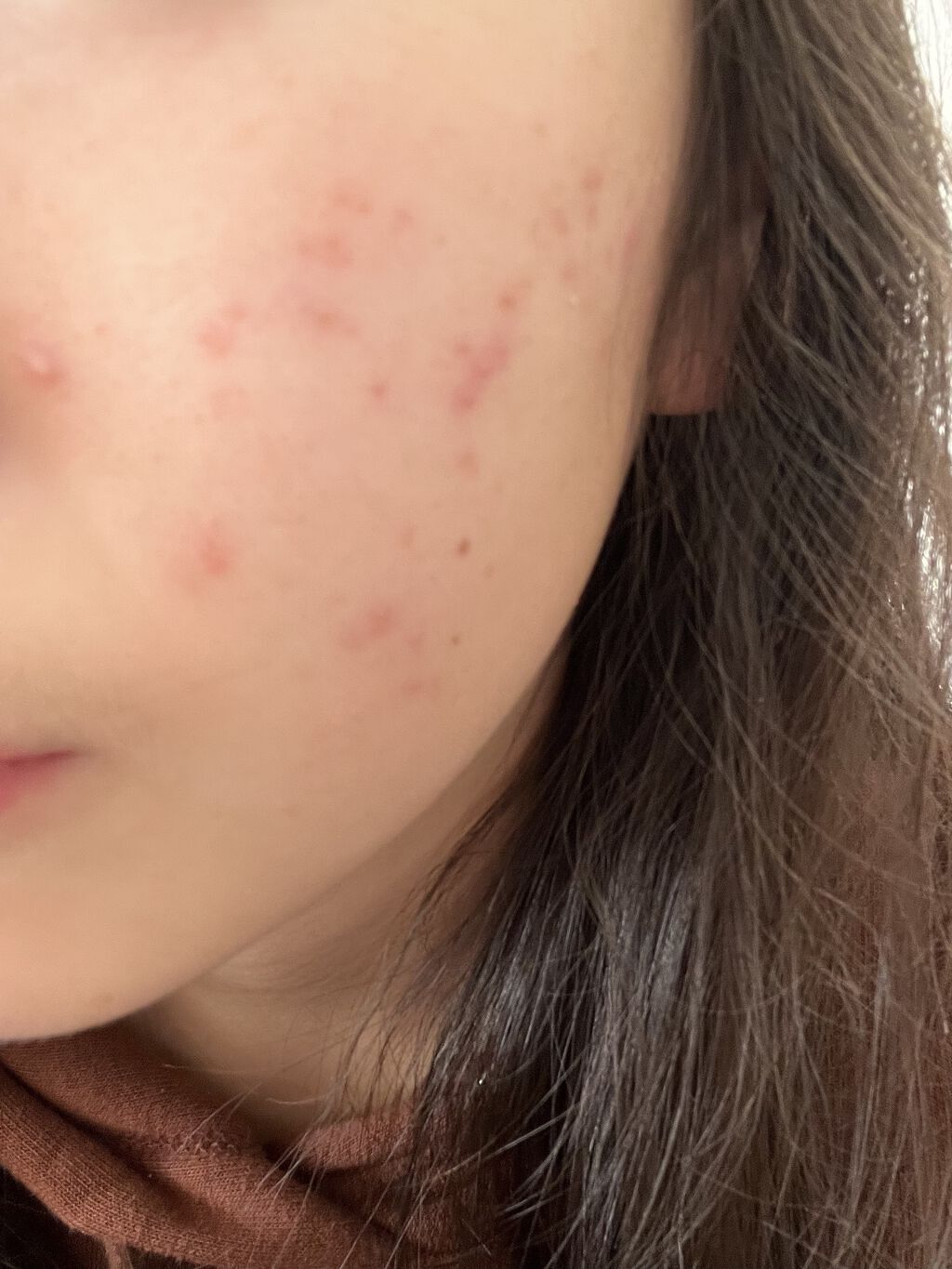 AC ウォッシングフォーム/NOV/洗顔フォームを使ったクチコミ（1枚目）