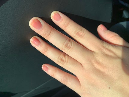 ミニネイル/media/マニキュアを使ったクチコミ(6枚目)