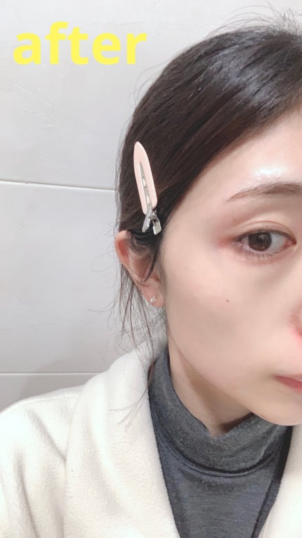 レチノール スーパーバウンス セラム/IOPE/美容液を使ったクチコミ(4枚目)