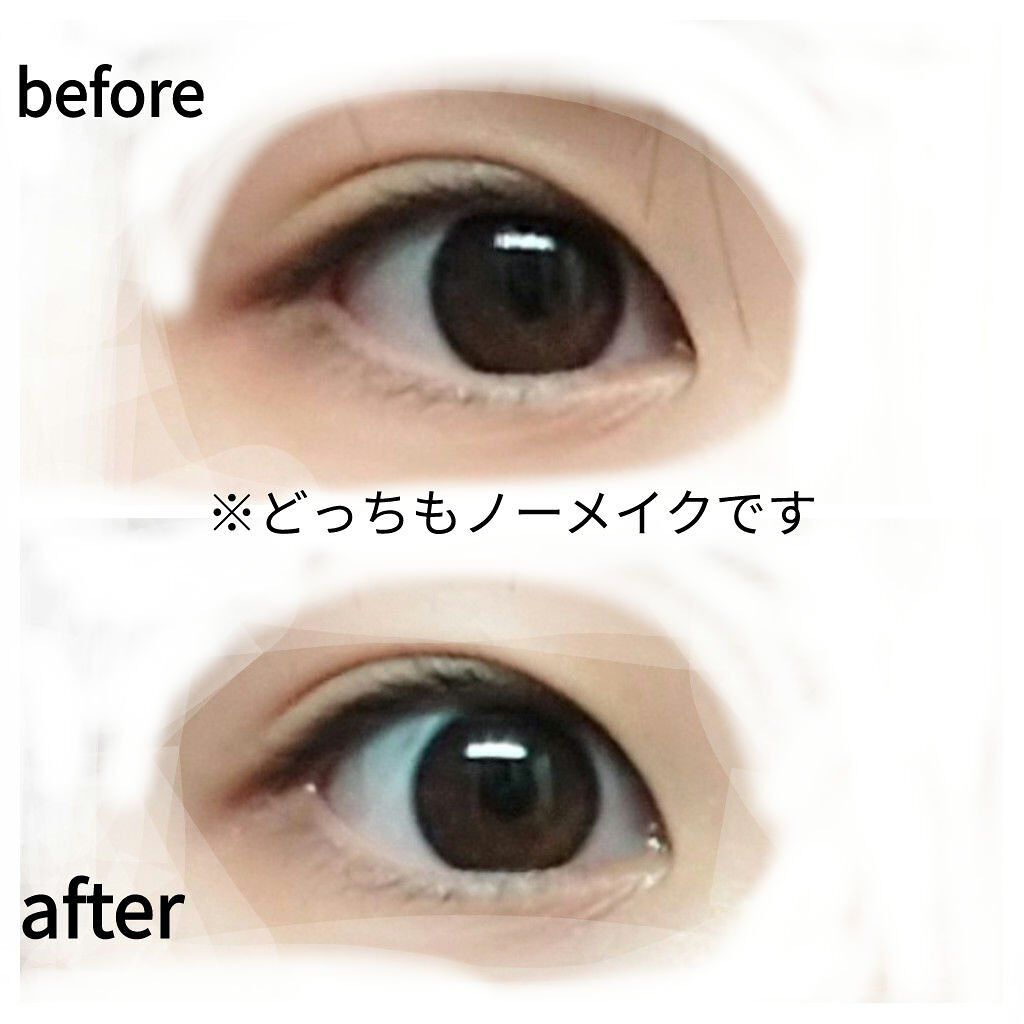 ロートリセ(医薬品)/ロート製薬/その他を使ったクチコミ（2枚目）