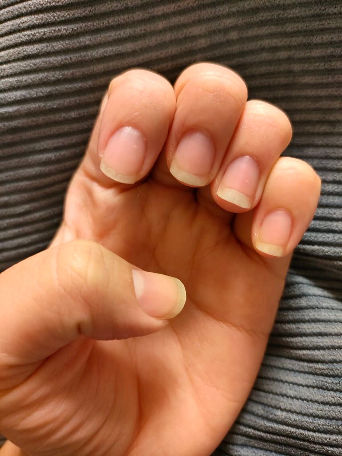 きくらげ on LIPS 「育爪日記vol.3んーあんまり前回の投稿と変わりないような、、..」(2枚目)