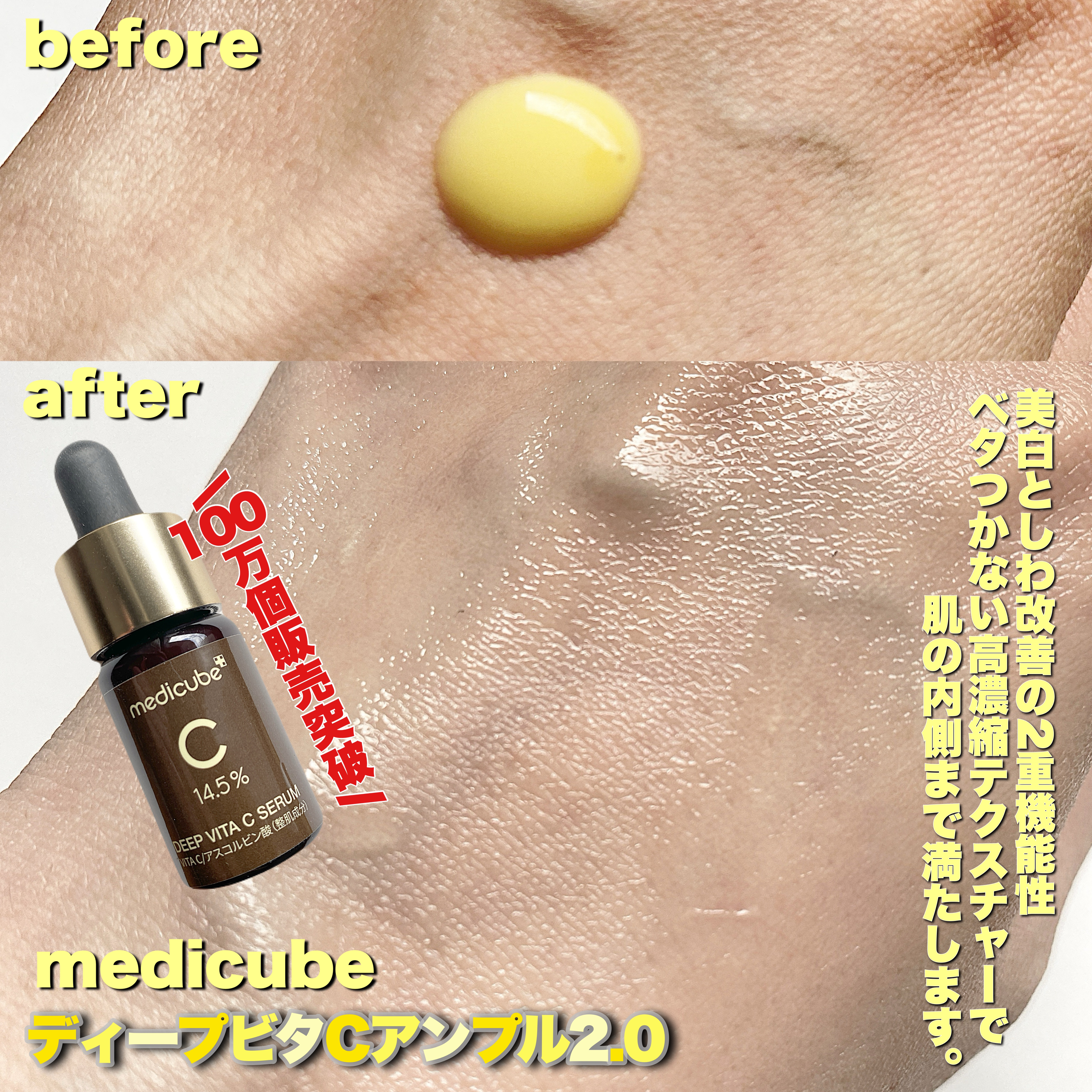 ディープビタCアンプル2.0/MEDICUBE/美容液を使ったクチコミ（2枚目）