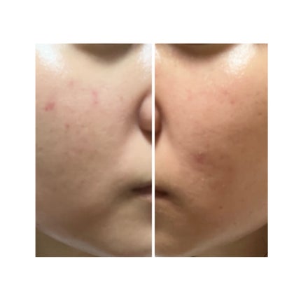 を使ったクチコミ(2枚目)