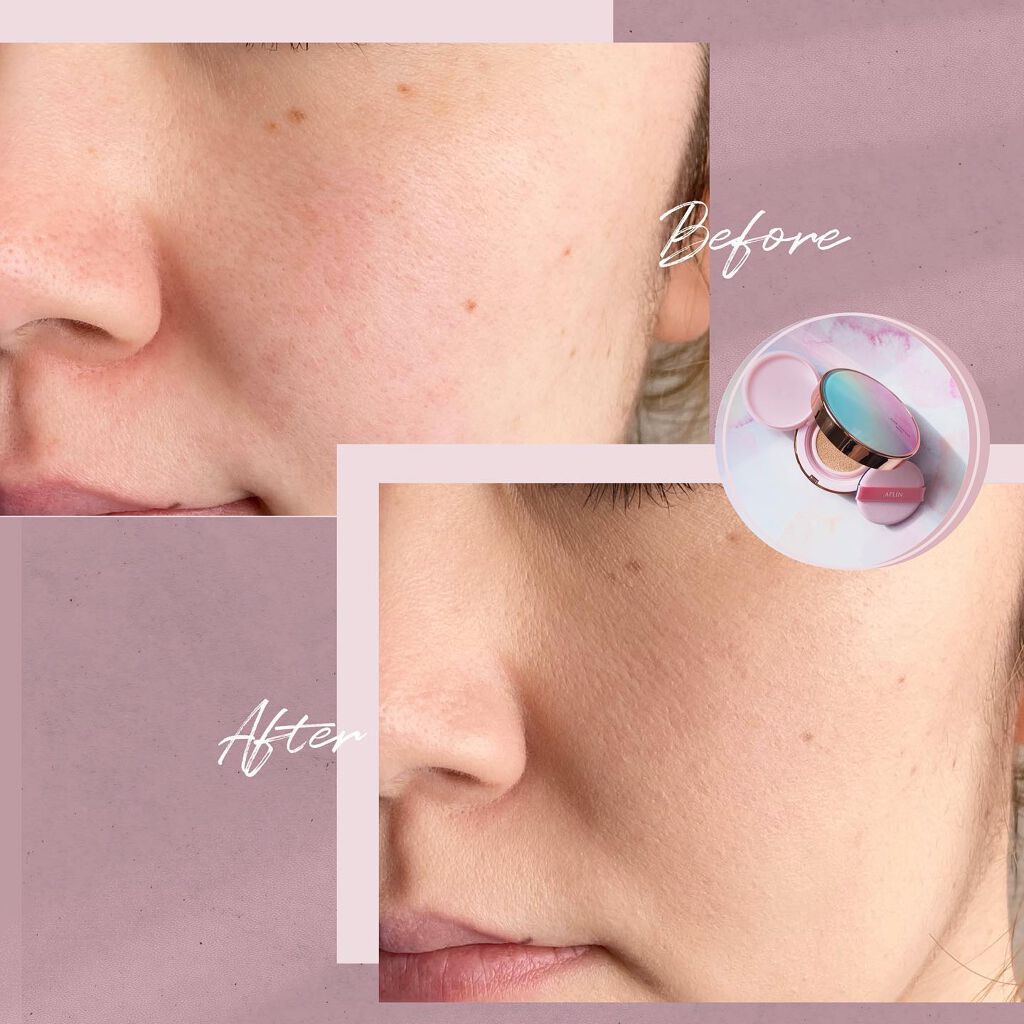 ピンクティーツリーカバークッション/APLIN/クッションファンデーションを使ったクチコミ(4枚目)