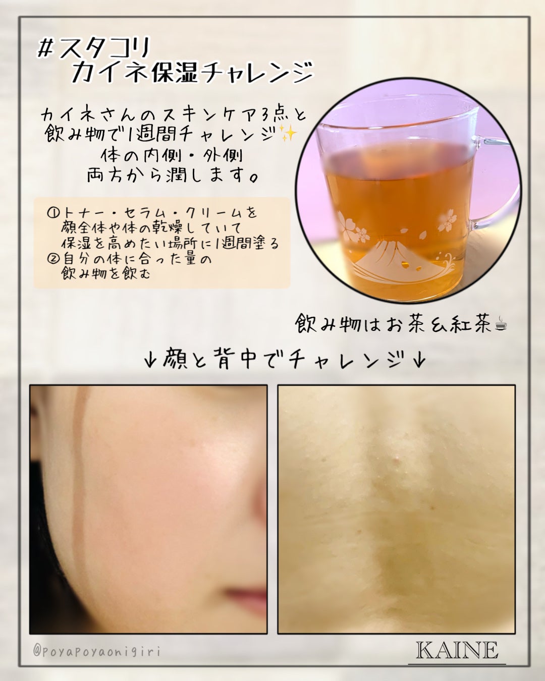 コンブバランスアンプルトナー/KAINE/化粧水を使ったクチコミ(3枚目)