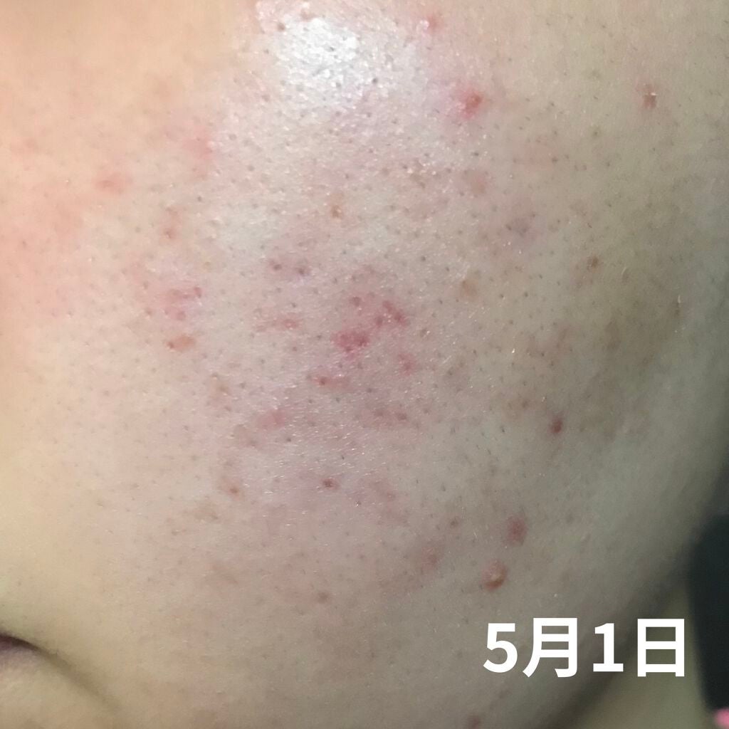 オリジナル ピュアスキンジェリー/ヴァセリン/ボディクリームを使ったクチコミ(2枚目)