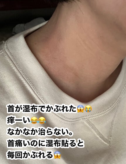 ひとりコスメ部 フォロバ100 on LIPS 「首が痛くて湿布貼ると毎回首がかぶれる😱😭痒いし赤くなるしなかな..」(1枚目)