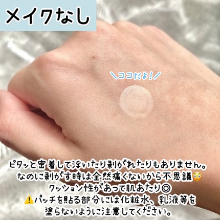 プロアクティブ スキンケアパッチ/プロアクティブ/にきびパッチを使ったクチコミ(4枚目)