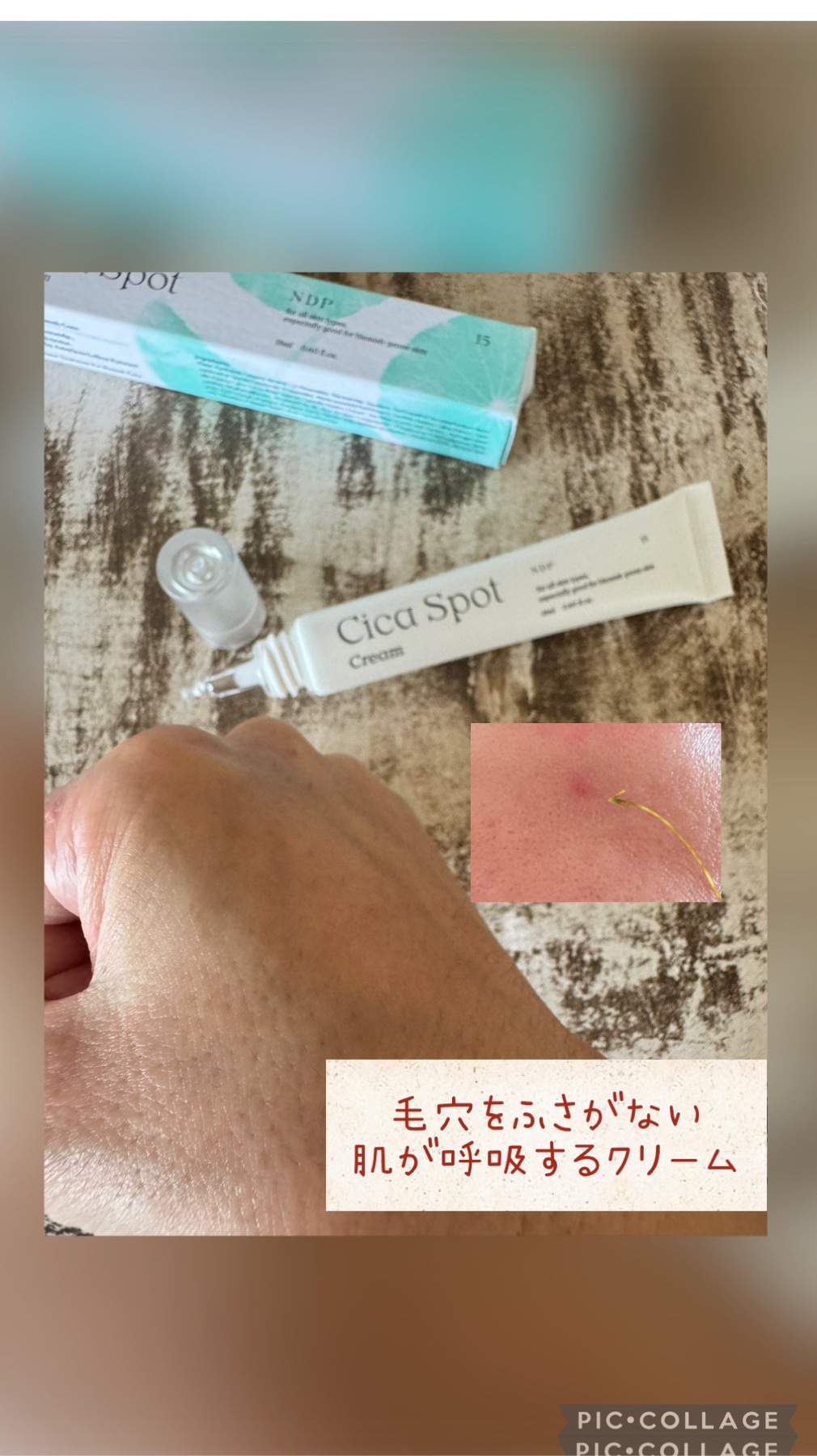 シカスポットクリーム/NATURAL DERMA PROJECT/フェイスクリームを使ったクチコミ（3枚目）