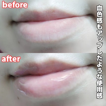 リッププランパー/フォーチュン/リッププランパーを使ったクチコミ(7枚目)