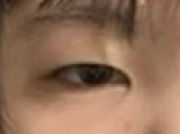 のびーるアイテープ(絆創膏タイプ、レギュラー)/DAISO/二重まぶた用アイテムを使ったクチコミ(1枚目)