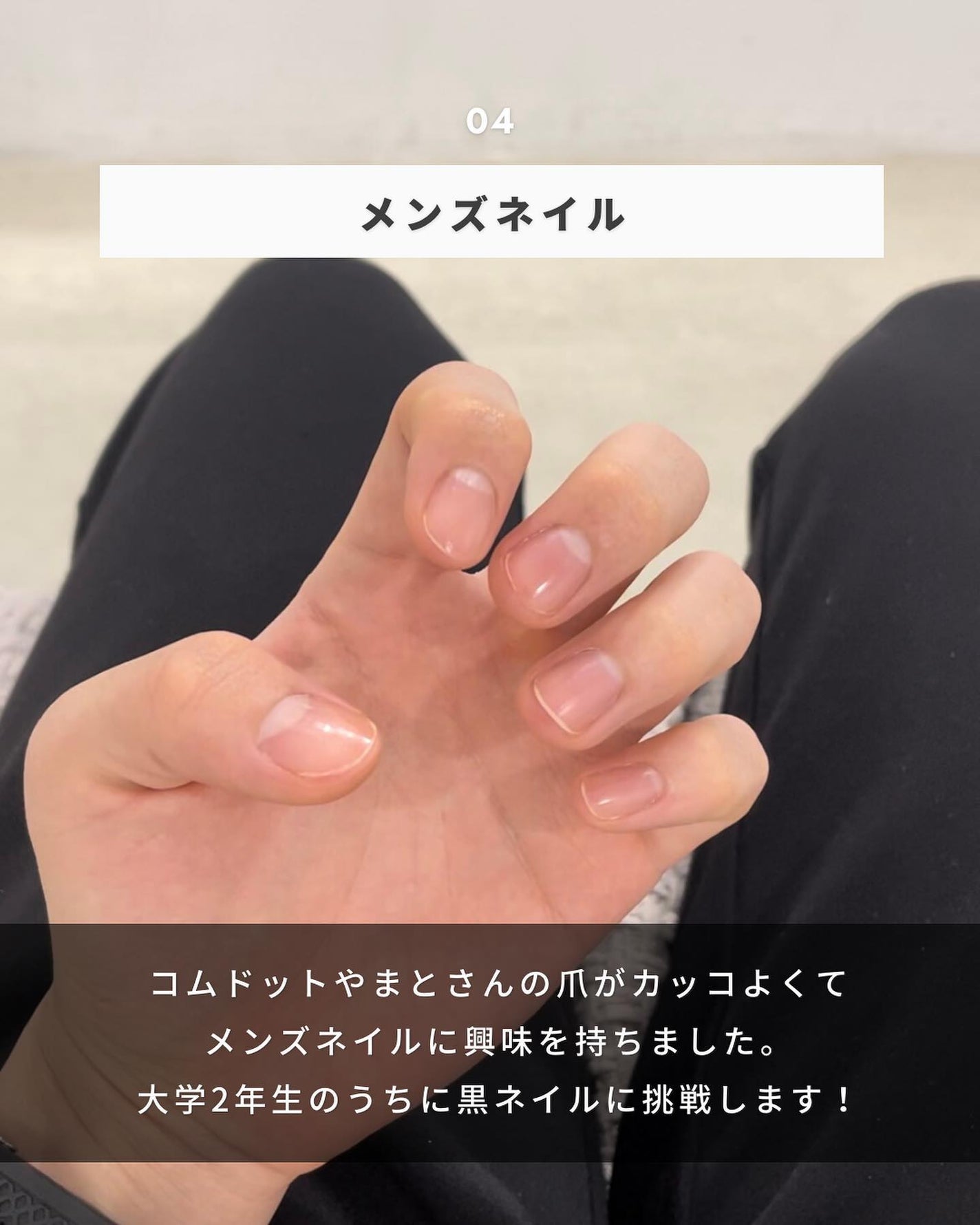 まえけん|ユニセックス美容 on LIPS 「@_mae.ken←ニキビを治してカッコよくなりたい男子はこち..」(5枚目)