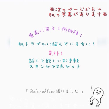 薬局で買えるあの商品達で肌荒れ改善したお話！！！

正直舐めておりました……

お肌のトラブルに悩んだ方なら一度は聞いたことがあるのではないかという子達のレビューでございます。

写真は約1ヶ月ほどの変