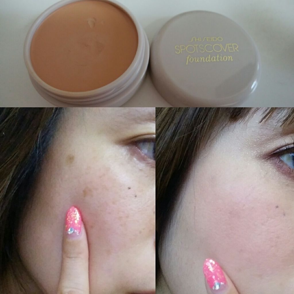 スポッツカバー ファウンデイション/SHISEIDO/クリームコンシーラーを使ったクチコミ（1枚目）