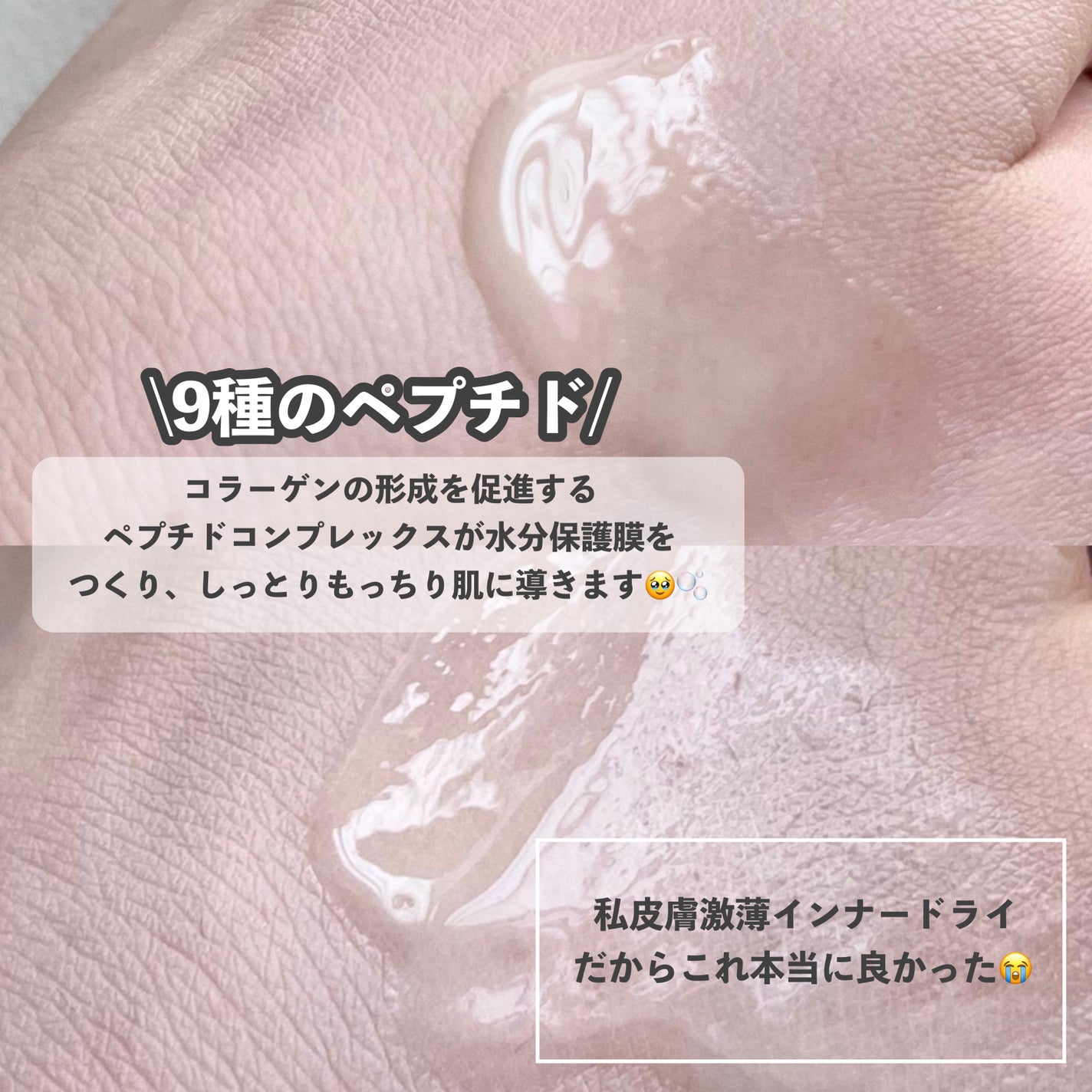Skin Barrier Calming Lotion/Ongredients/乳液を使ったクチコミ(4枚目)