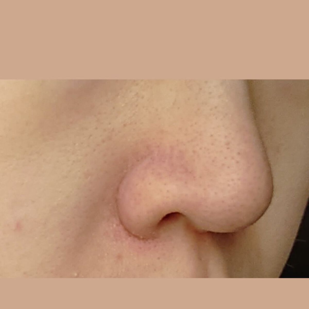 ベビーオイル/シャイビー/ボディオイルを使ったクチコミ（3枚目）