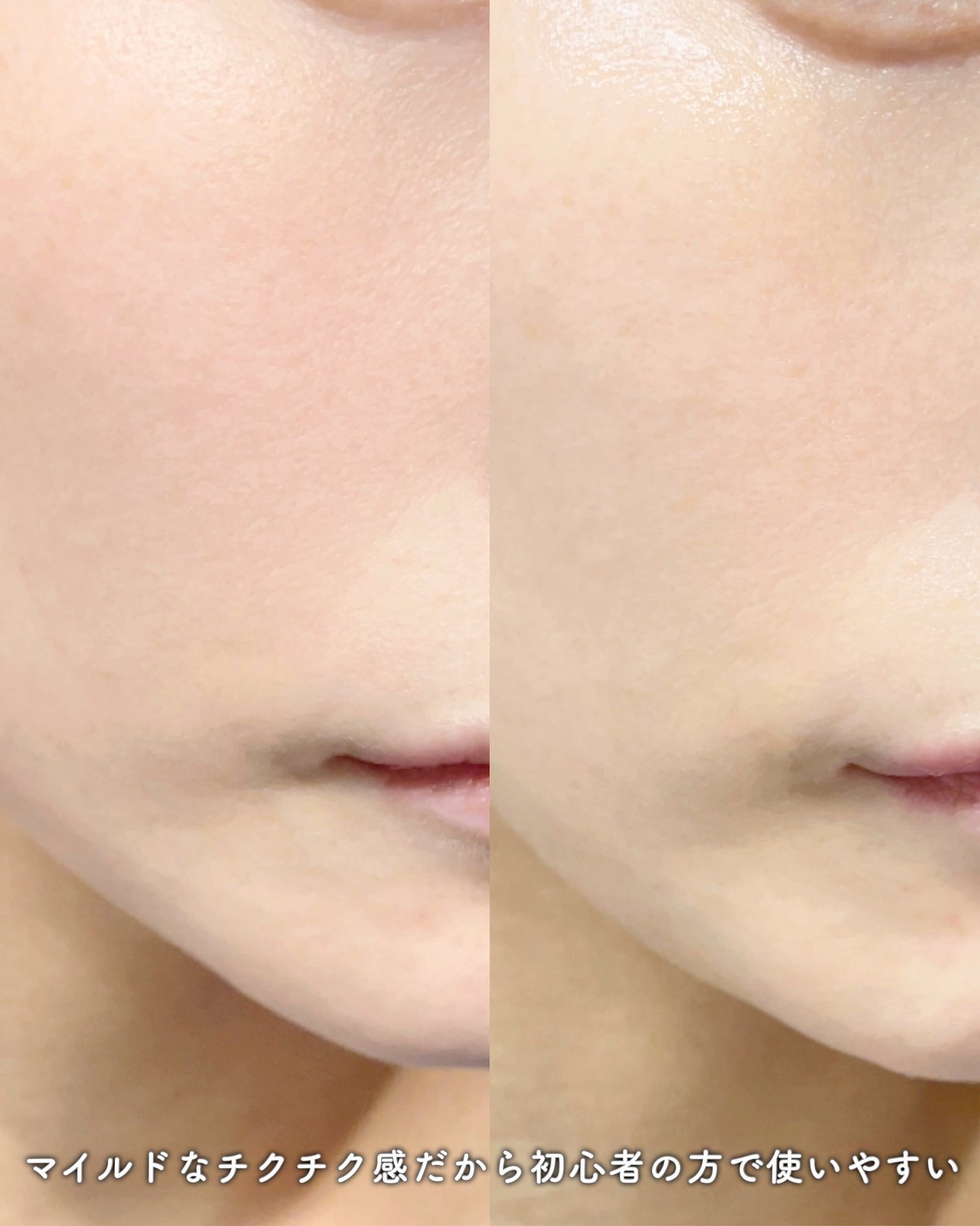 NDSポイントショット2000アンプル/ISOI/美容液を使ったクチコミ(4枚目)