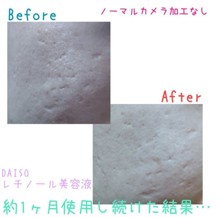 ハトムギ化粧水/ドン・キホーテプライベートブランド 情熱価格/化粧水を使ったクチコミ(1枚目)