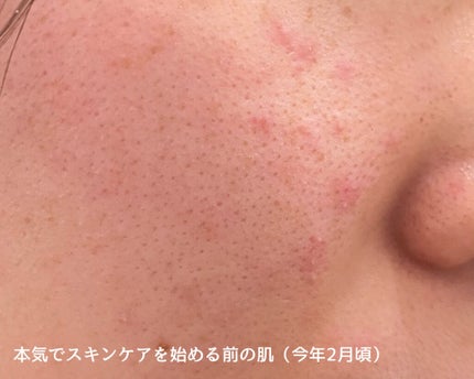 クリアケア化粧水 高保湿タイプ/無印良品/化粧水を使ったクチコミ(2枚目)