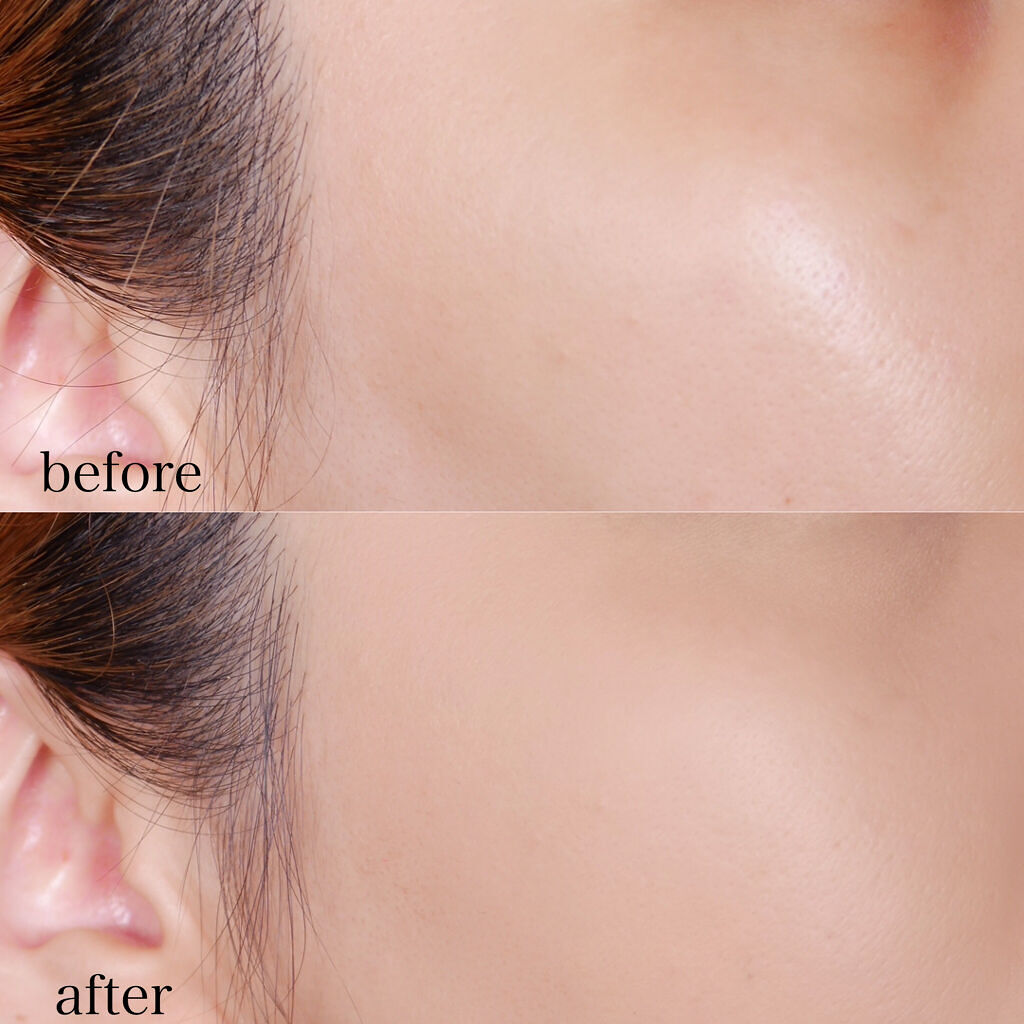 薬用 スキンケアファンデーション（パウダリー）/d プログラム/パウダーファンデーション by nana