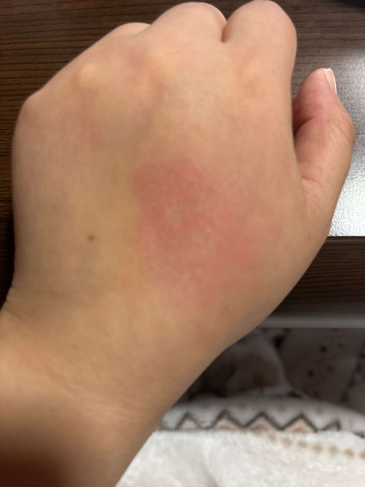 チークトクトク/AMUSE/リキッドチークを使ったクチコミ(4枚目)