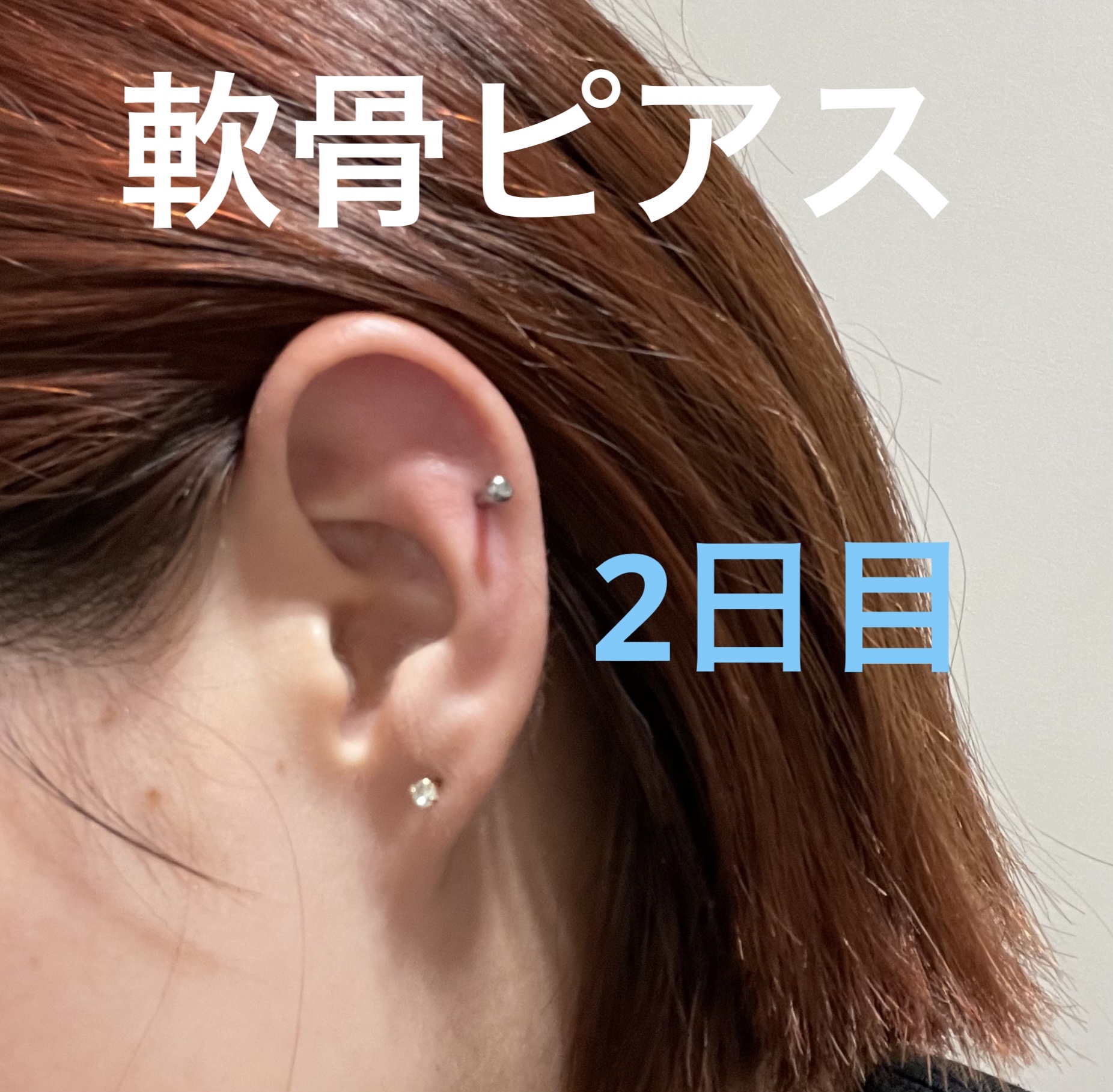 瞬間ピアッサー Q66/ヒーロー /その他を使ったクチコミ（1枚目）