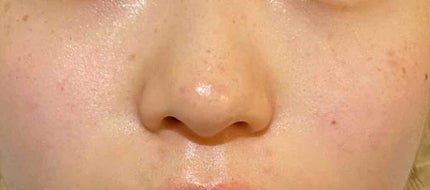 化粧水・敏感肌用・高保湿タイプ/無印良品/化粧水を使ったクチコミ(4枚目)