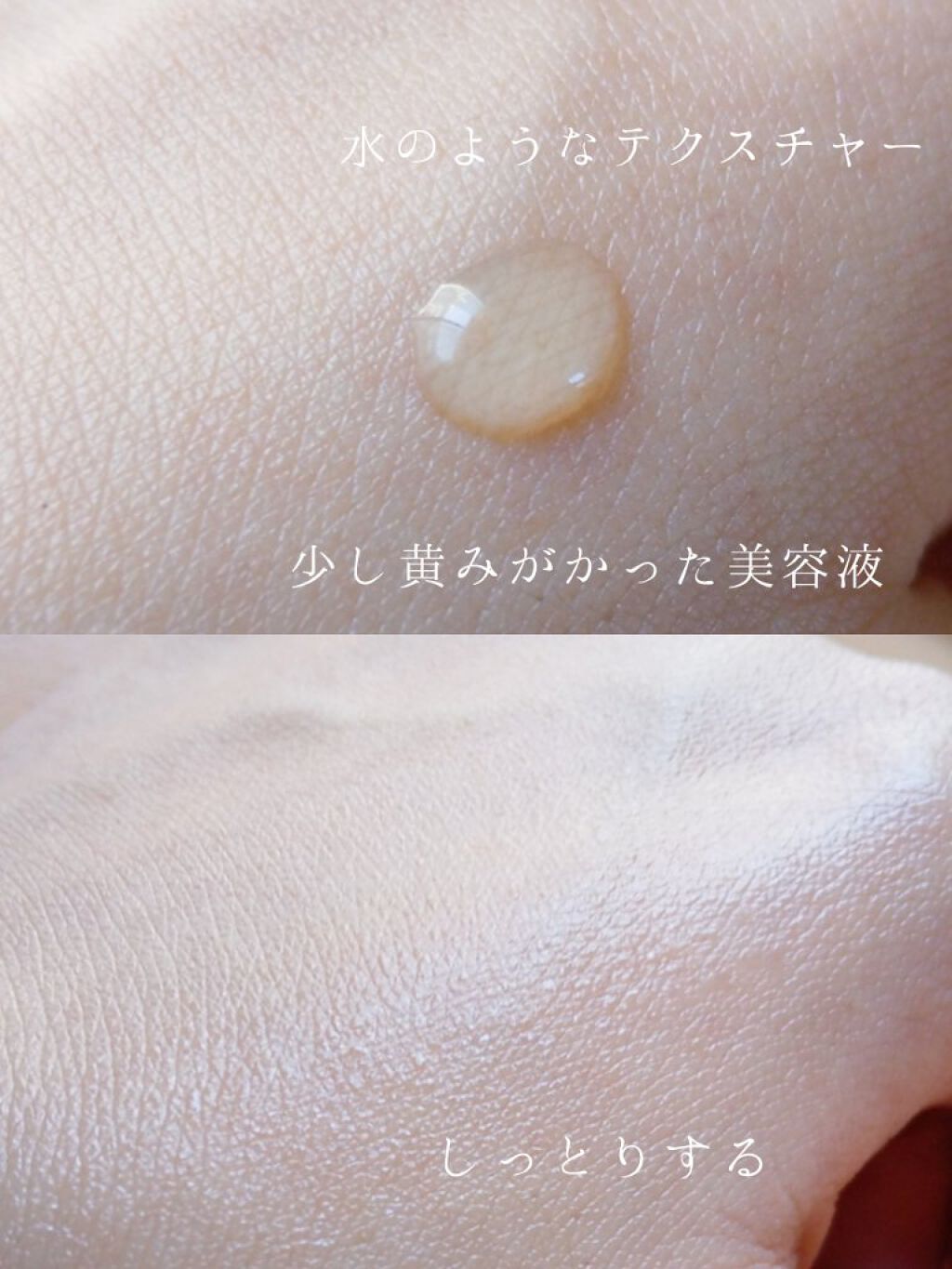 ウィッチヘーゼルエキス（ハマメリス葉エキス）/TUNEMAKERS/美容液を使ったクチコミ（3枚目）