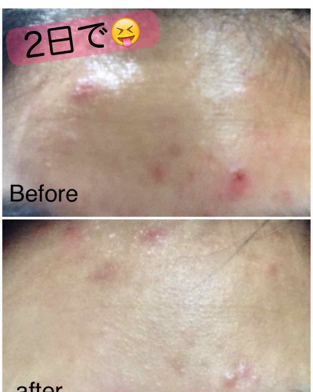 明色美顔水 薬用化粧水/美顔/化粧水を使ったクチコミ(1枚目)