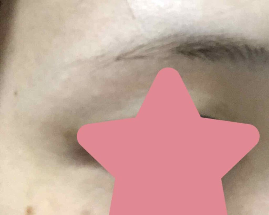 ジョレン クリーム ブリーチ/ジョレンジャパン/ムダ毛ケアを使ったクチコミ（2枚目）