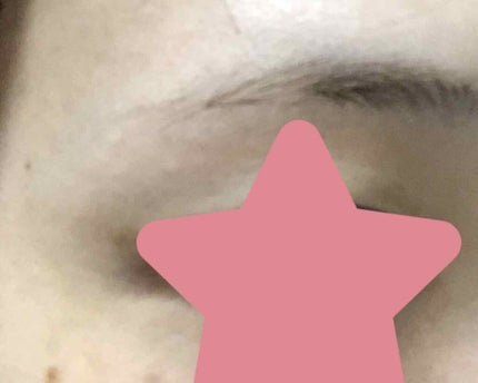 ジョレン クリーム ブリーチ/ジョレンジャパン/ムダ毛ケアを使ったクチコミ(2枚目)