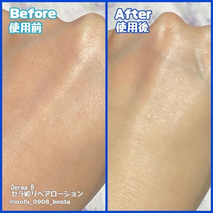セラMD リペアローション/Derma:B/ボディローションを使ったクチコミ(3枚目)