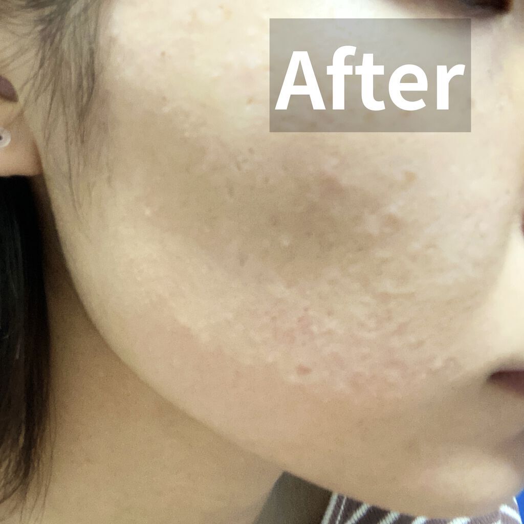 メイクとろりんなで落ちジェル/ビオレ/クレンジングジェルを使ったクチコミ（3枚目）