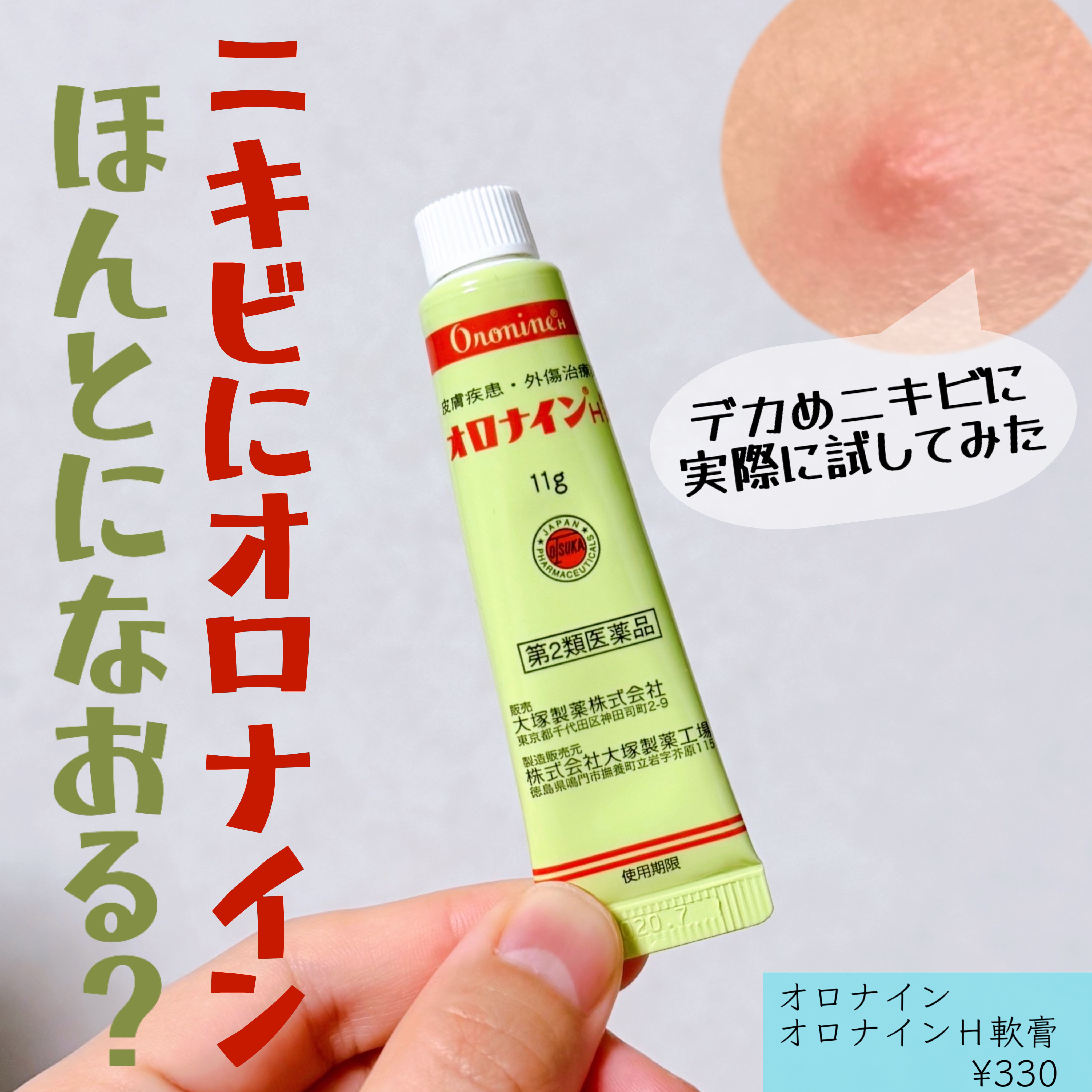 オロナインＨ軟膏 (医薬品)/オロナイン/その他を使ったクチコミ（1枚目）