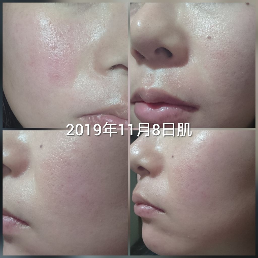 ドクタージャルト シカペア クリーム （第2世代）/Dr.Jart＋/フェイスクリームを使ったクチコミ（2枚目）