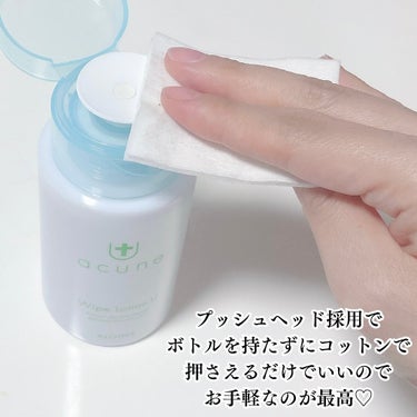 アキュネ 薬用ふきとりローションU/アキュネ/拭き取り化粧水を使ったクチコミ（3枚目）