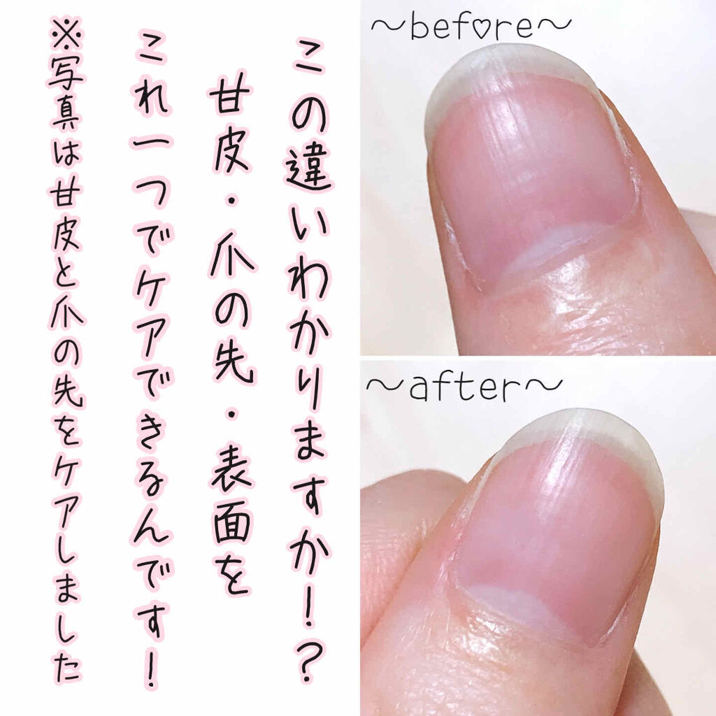 電動ネイルケア/キャンドゥ/ネイル用品を使ったクチコミ（2枚目）