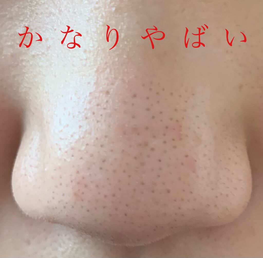 ザ クレンジングバーム ブラック Duoの口コミ あのduo黒ほんとに効果あるのか 検証 By サバの味噌煮 混合肌 10代後半 Lips ザ クレンジングバーム ブラック Duoの口コミ あのduo黒ほんとに効果あるのか 検証 By サバの味噌煮 混合肌 10代後半 Lips