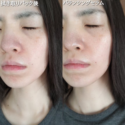 ダーマトラブルバランシングセラム/フシダイン/美容液を使ったクチコミ(10枚目)