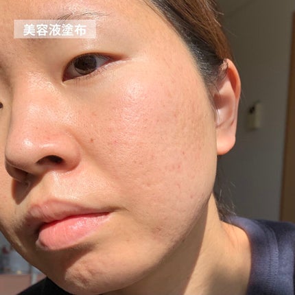 ガラクナイアシン2.0エッセンス/manyo/美容液を使ったクチコミ(7枚目)