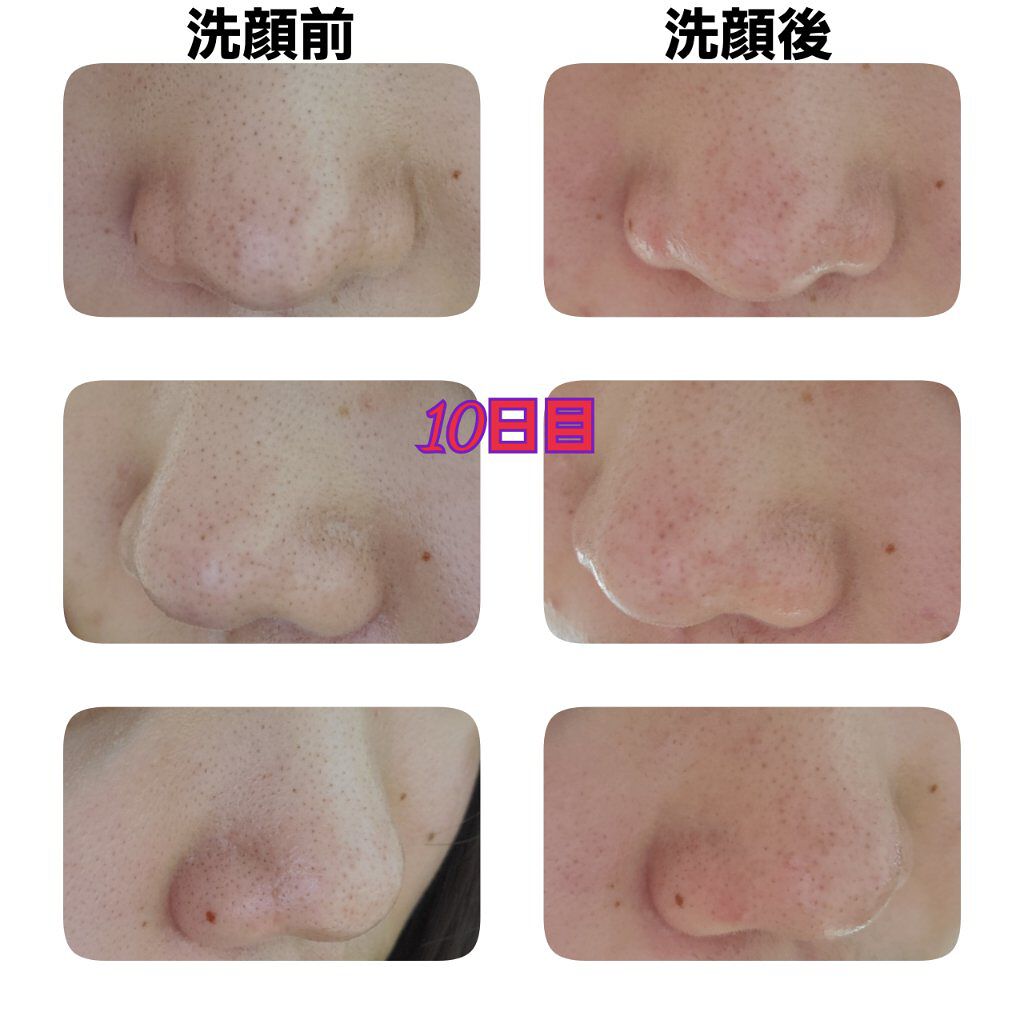 デュオ ザ クレンジングバーム ブラック/DUO/クレンジングバームを使ったクチコミ（3枚目）