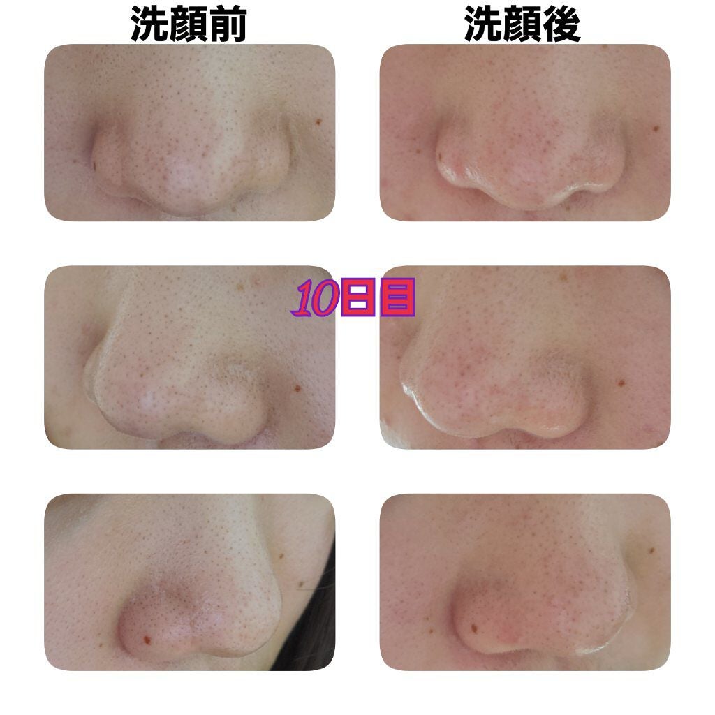 オードムーゲ 薬用ローション(ふきとり化粧水)/オードムーゲ/拭き取り化粧水を使ったクチコミ(3枚目)