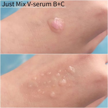 Just Mix V-serum B+C/iMPL/美容液を使ったクチコミ（3枚目）