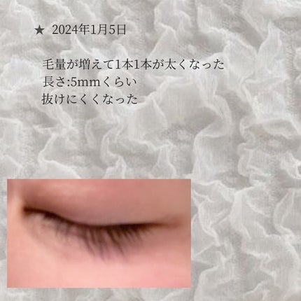 アイラッシュセラム/THE STEM CELL/まつげ美容液を使ったクチコミ(3枚目)