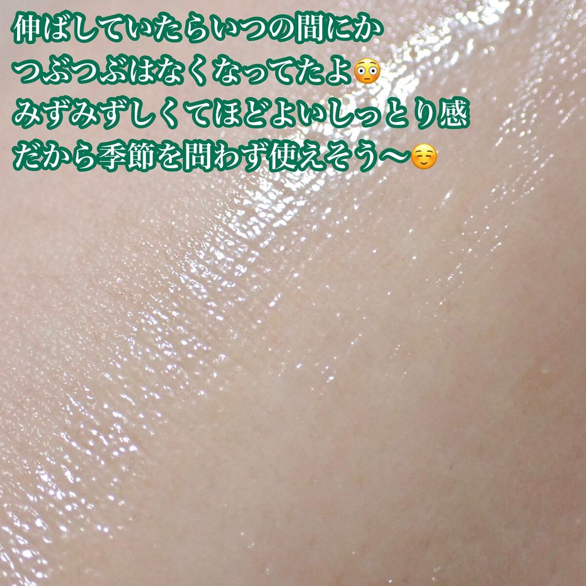 ビタペアC クリーム/ネイチャーリパブリック/フェイスクリームを使ったクチコミ(6枚目)