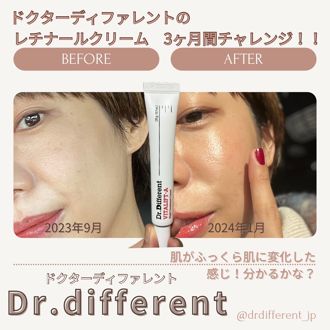 VITALIFT A forte/Dr.Different/フェイスクリームを使ったクチコミ（2枚目）